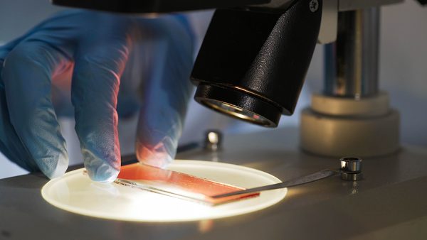 Medical scientist studying blood sample under microscope