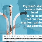 Peyronie's disease causes a distinct bend in the penis that can make erections painful and sex difficult.